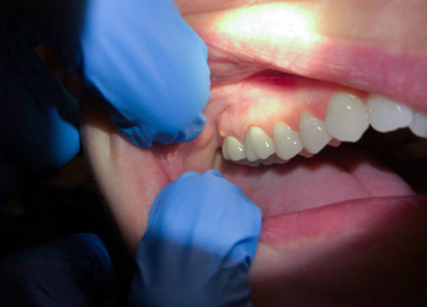 Best Emergency Cosmetic Dentistry (e.g., broken veneers) in Bella Vista, CA