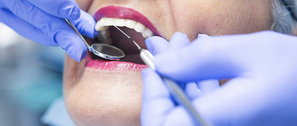 Best Walk-In Emergency Dental Services in Bella Vista, CA